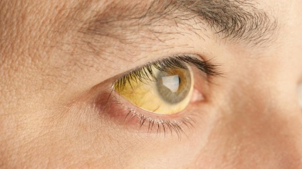 8 Semnale cu care ochii avertizează asupra problemelor de sănătate! Fiți atenți!
