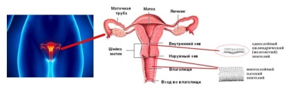 Boli ale colului uterin