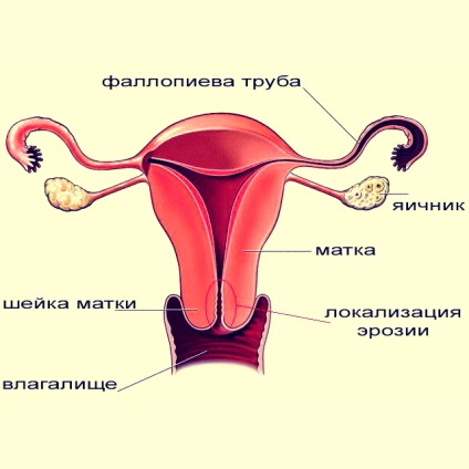 Boli ale colului uterin