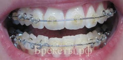 Mitino în clinica ortodontului