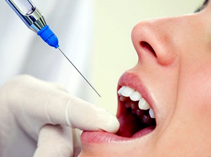 Mit kell tudni a fogászat anesztéziseiről?