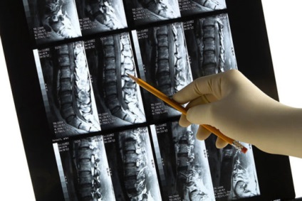 Care este coloana vertebrală și cum este diagnosticată aceasta?