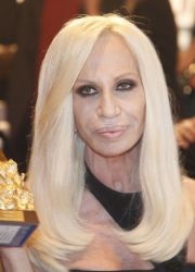 Donatella Versace - előtt és után