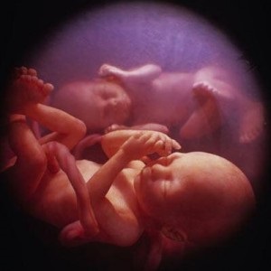 Duplicatul uter și sarcina, cauze de patologie