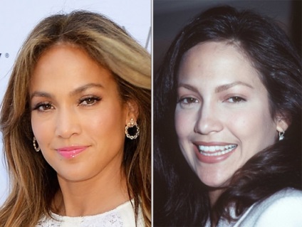 Jennifer Lopez N-am făcut niciodată o intervenție chirurgicală plastică, o bârfă