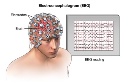 Electroencefalograma, rheoencefalograma - rețea de centre medicale, generație sănătoasă