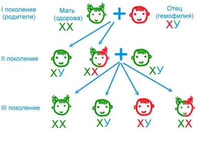 Гемофілія у дитини що необхідно знати кожному з батьків