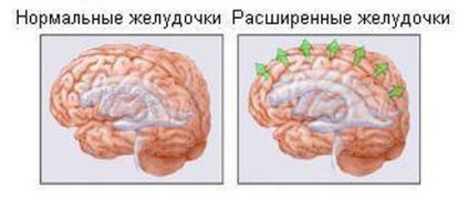 Portalul informativ Togliatti