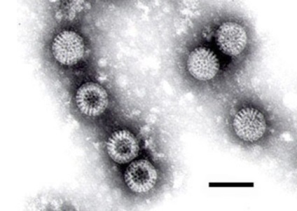 Studiul fecalelor pentru rotavirus - cauza principală a diareei la copii