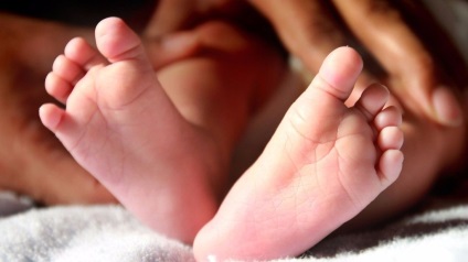 Cum să tratați displazia șoldului la nou-născuți