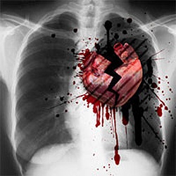 Care sunt simptomele infarctului miocardic - tratamentul inimii