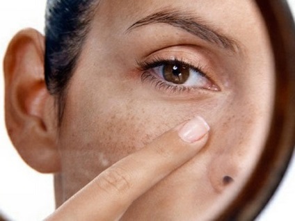 Cum să îndepărtați fața pigmentată de pe față de acasă