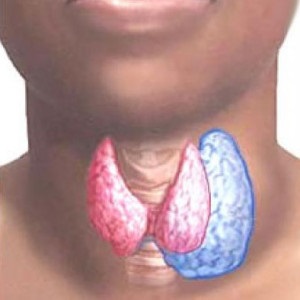 Nodul tiroidian calcificat - viața mea