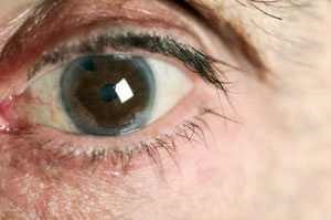 Picaturi pentru ochi din cataracta, picaturi pentru ochi, recuperarea vederii