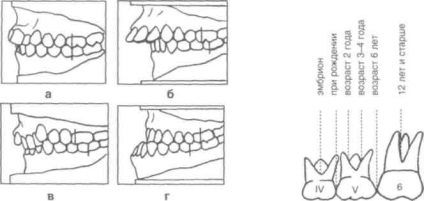 Clasificarea anomaliilor dentoalveolare și a metodelor de diagnostic în ortodonție