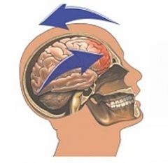 Concussion - consecințe, tratament, simptome