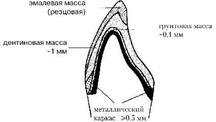 Cursul 11 ​​ceramica dentară