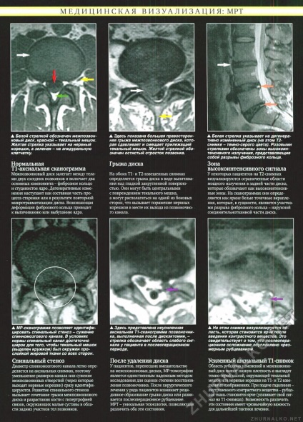 Imagistica medicală mrt - corpul uman №65, pagina 16