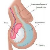 Meningita - tratamentul meningitei prin parcele