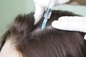 Mezoterapie pentru preparate de creștere a părului, recenzii