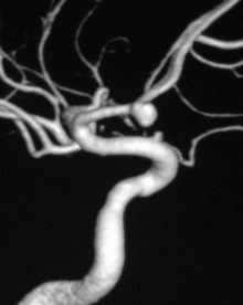 Vasele de sânge de vărsături ale prețului pentru angiografia mr vaselor (arterelor și venelor) în spb