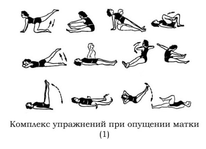 Omiterea uterului - ce trebuie să faceți