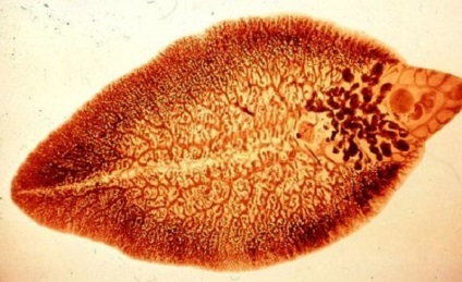 Hepatic fluke ca unul se poate infecta moduri si moduri