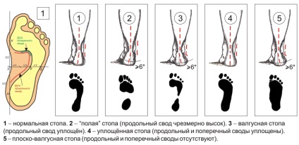 Aplatizarea simptomelor și a tratamentului la adulți și copii