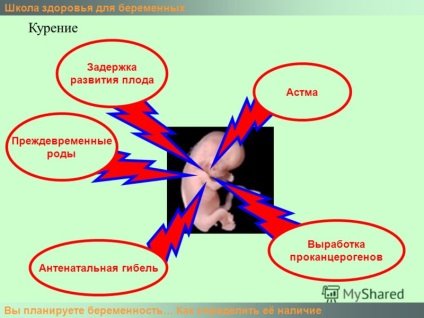 Prezentarea pe școala de sănătate a femeilor însărcinate pe care intenționați să o primiți