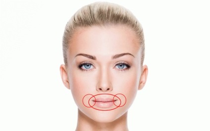 Acneea din jurul gurii determină și caracteristicile tratamentului