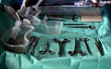 Vindeți un rinichi, cumpărați un nou ipad 15 fapte teribile despre transplantul de organe