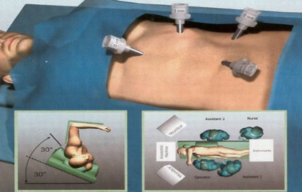 Prostatectomie, Departamentul de Chirurgie High-Tech a Clinicii de Urologie