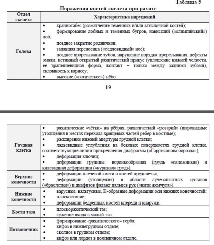 Simptomele rahitismului la copii, consultarea unui pediatru în Minsk