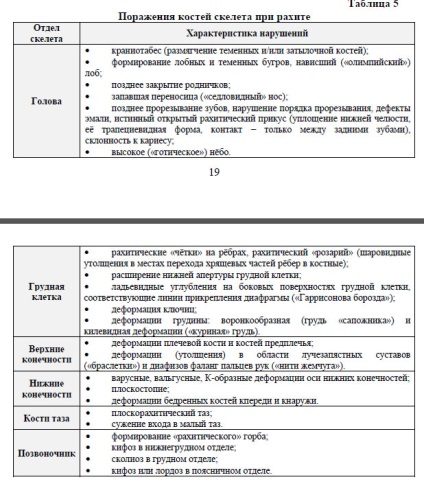 Симптоми на рахит при децата, педиатрична консултация в Минск