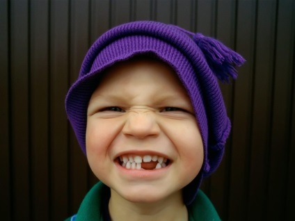 Modificarea dinților laptelui de către constanta pe care părinții ar trebui să o cunoască