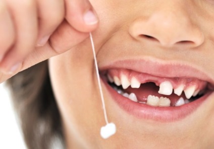 Metode de îndepărtare a dinților din lapte fără durere