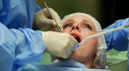 Extragerea dinților sub anestezie