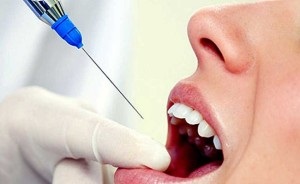 Extragerea dinților sub anestezie