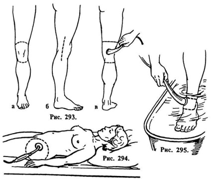 Terapia cu ultrasunete