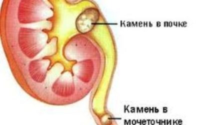 Urolesan cu cistită, indicații de utilizare, contraindicații și efecte secundare