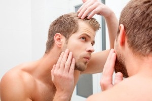 Mi az oka a hajhullás a fejét a férfi gének vagy életmód, ifjúsági központ