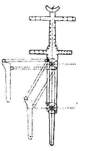 Xiv «mechanikus láb”