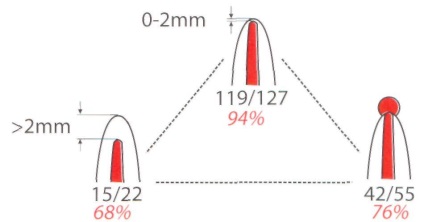 02 Evaluarea calității tratamentului endodontic