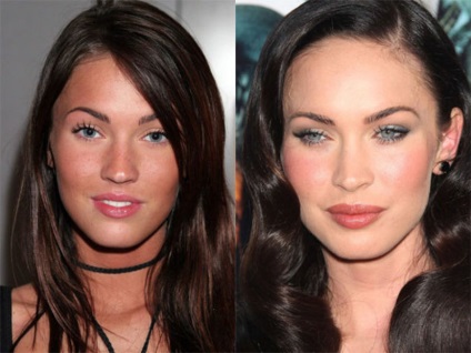 15 Celebrități, terminând rău cu Botox - știri în fotografii