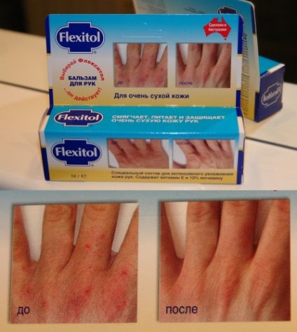 Balm flexitol de mână - salvare pentru revizuiri de piele foarte uscată
