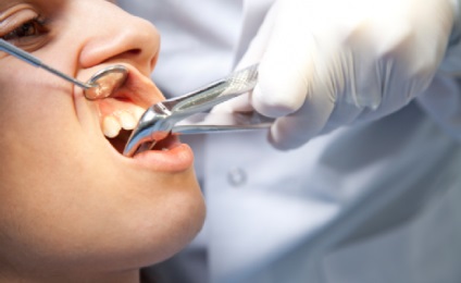 Fáj, ha húzni a fogat eltávolítási eljárás