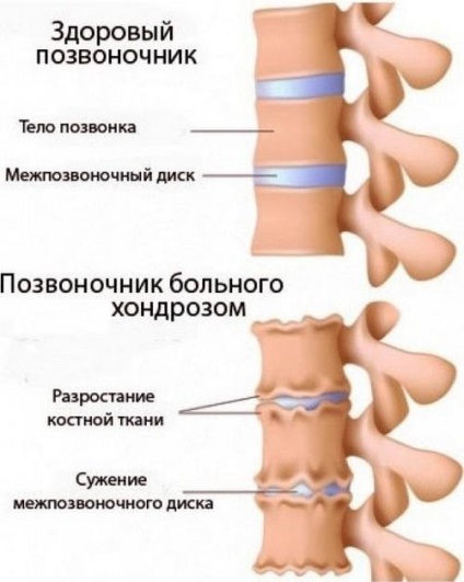 Durerea în ochi și capul în partea frontală cu clipire și apăsare, strălucire, tăiere, ascuțită, pâlpâire