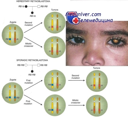 Terapia genetică a cancerului (cancer)