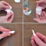 Cum să tratați eficient ciuperca de unghii pe picioare cu rețete de iod și recenzii