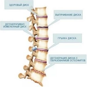 Як зміцнити м'язи спини йога, фітнес, плавання, домашні тренування